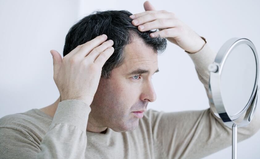植发有什么危害和副作用？明星脱发为什么不植发？