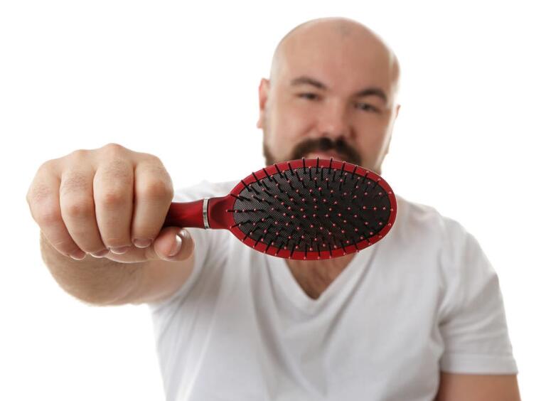 雄性激素脱发和脂溢性脱发一样吗？肾虚型脱发和脂溢性脱发的区别