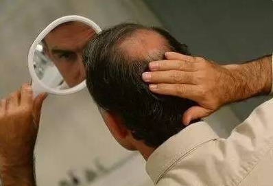内分泌脱发症状表现，男性内分泌失调脱发怎么检查